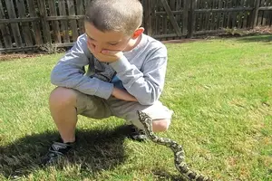 meaning-dream-snake-bites-attacks-my-little-son